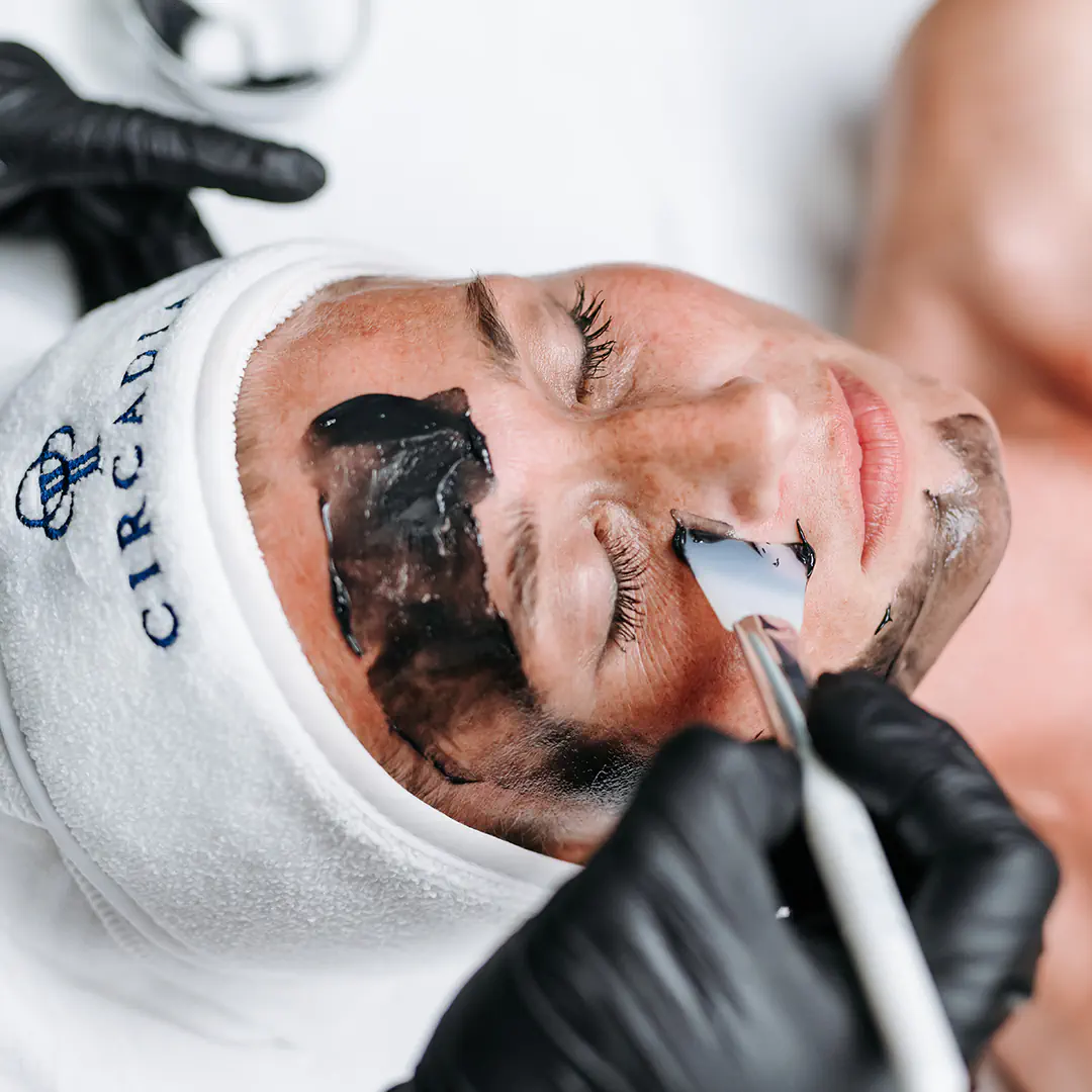 acne facial treatment gold coast