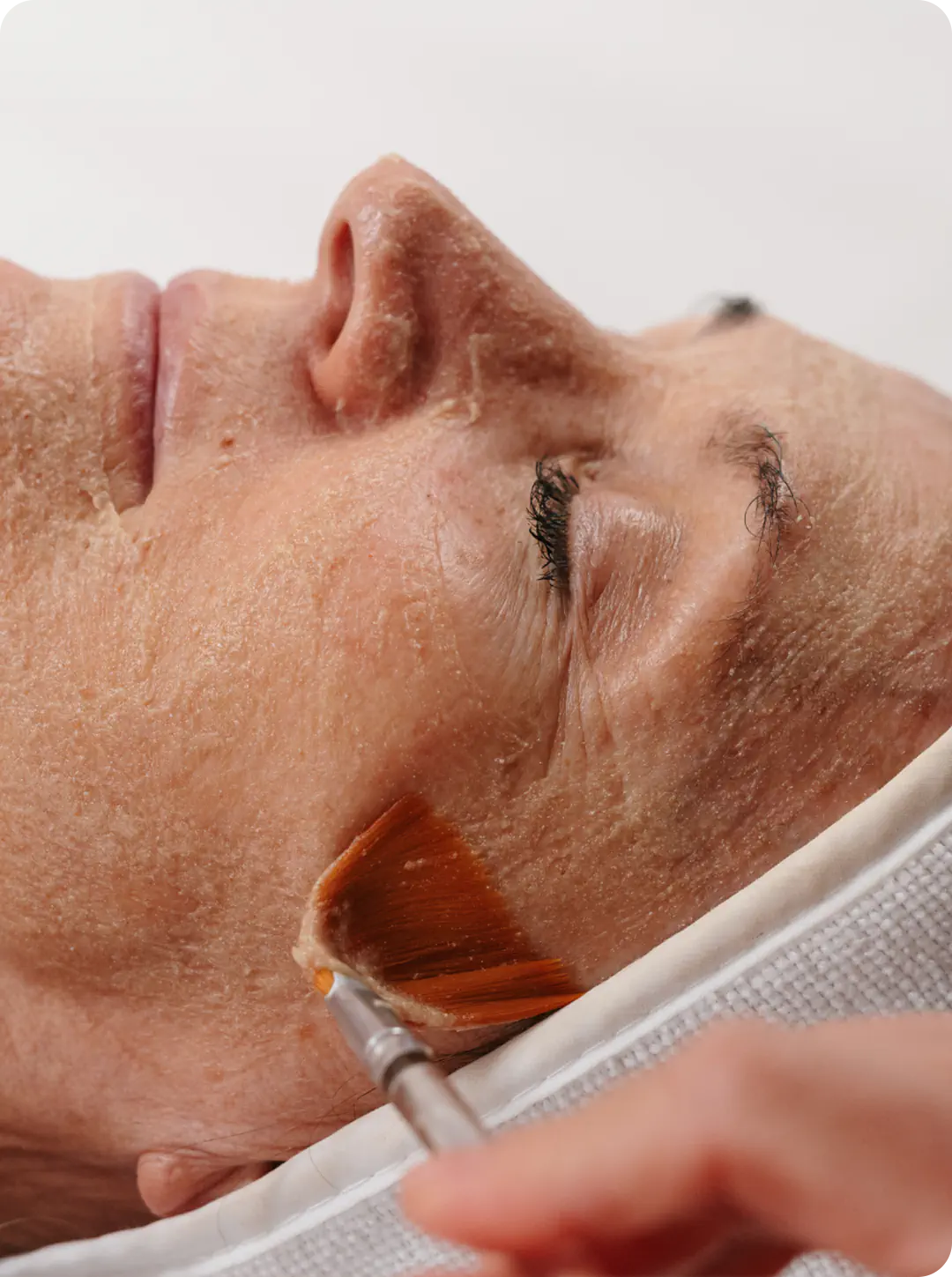 enzyme facial treatments gold coast