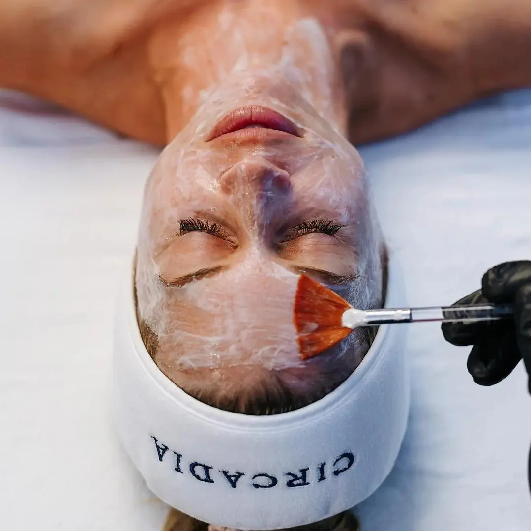 lactic acid peel gold coast