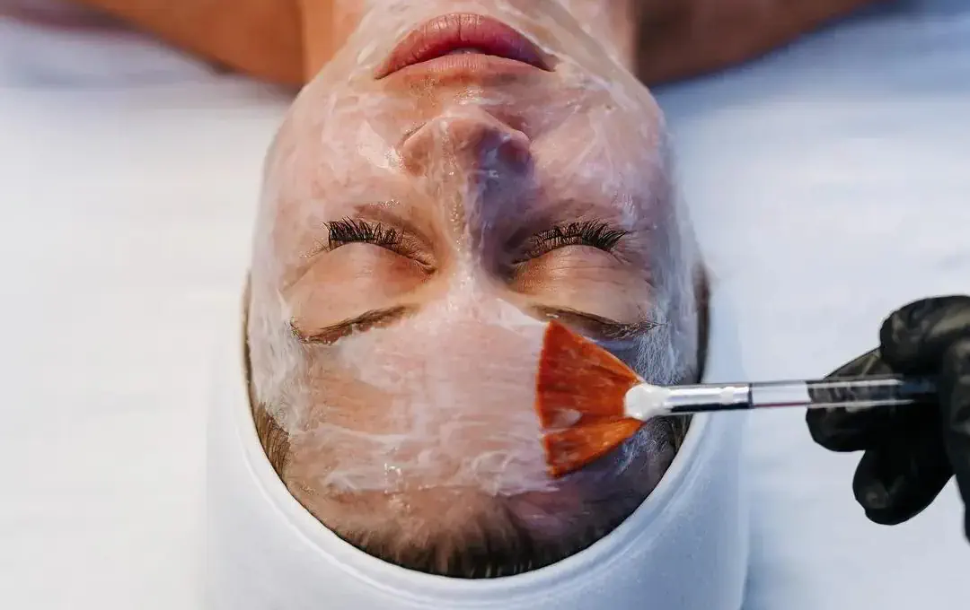 lactic-acid-peel-treatment
